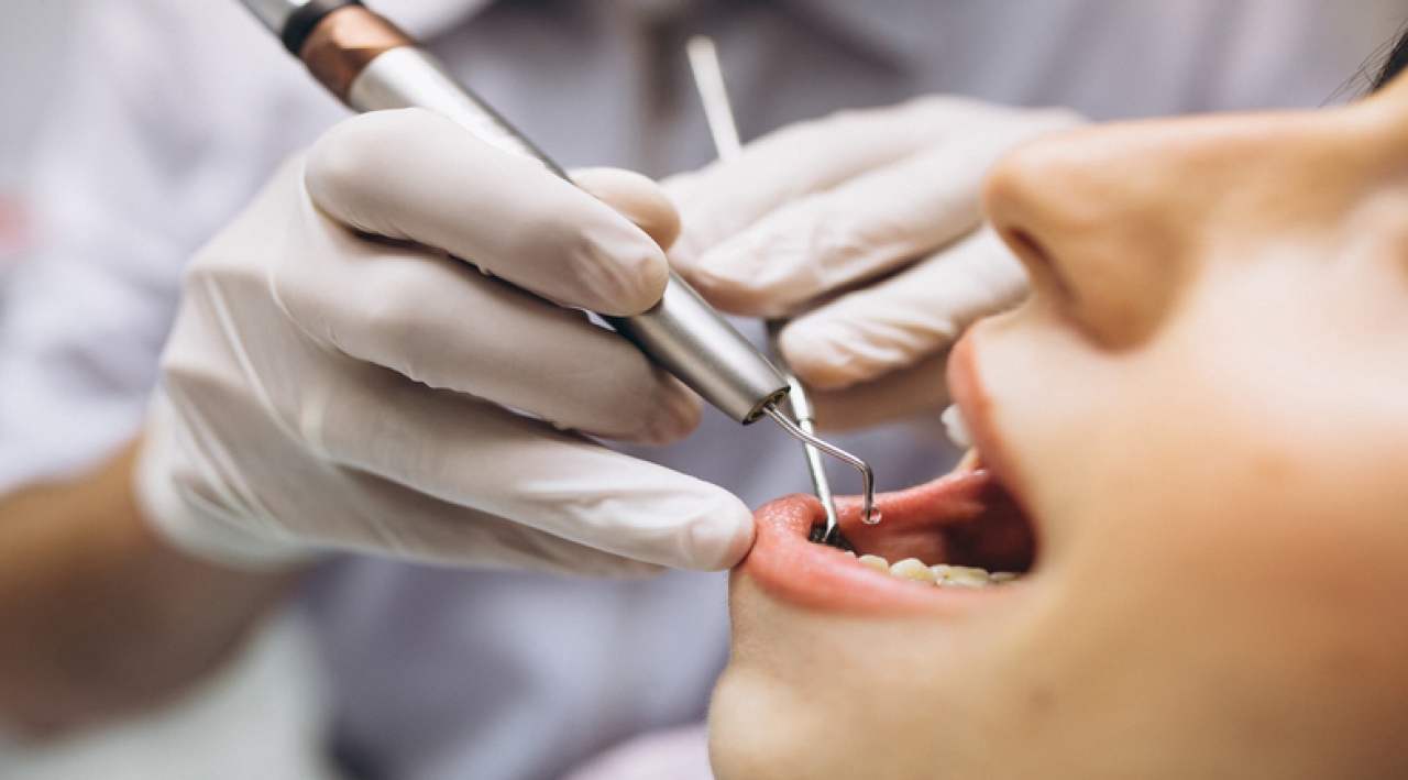 Μύθοι και αλήθειες σχετικά με την αισθητική οδοντιατρική
