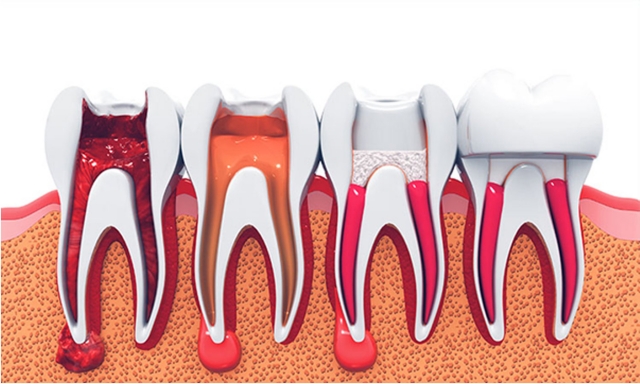 &Phi;&lambda;&epsilon;&gamma;&mu;&omicron;&nu;ή &kappa;&alpha;&iota; &sigma;&upsilon;&mu;&pi;&tau;ώ&mu;&alpha;&tau;&alpha; &sigma;&epsilon; &alpha;&pi;&omicron;&nu;&epsilon;&upsilon;&rho;&omega;&mu;έ&nu;&omicron; &delta;ό&nu;&tau;&iota;